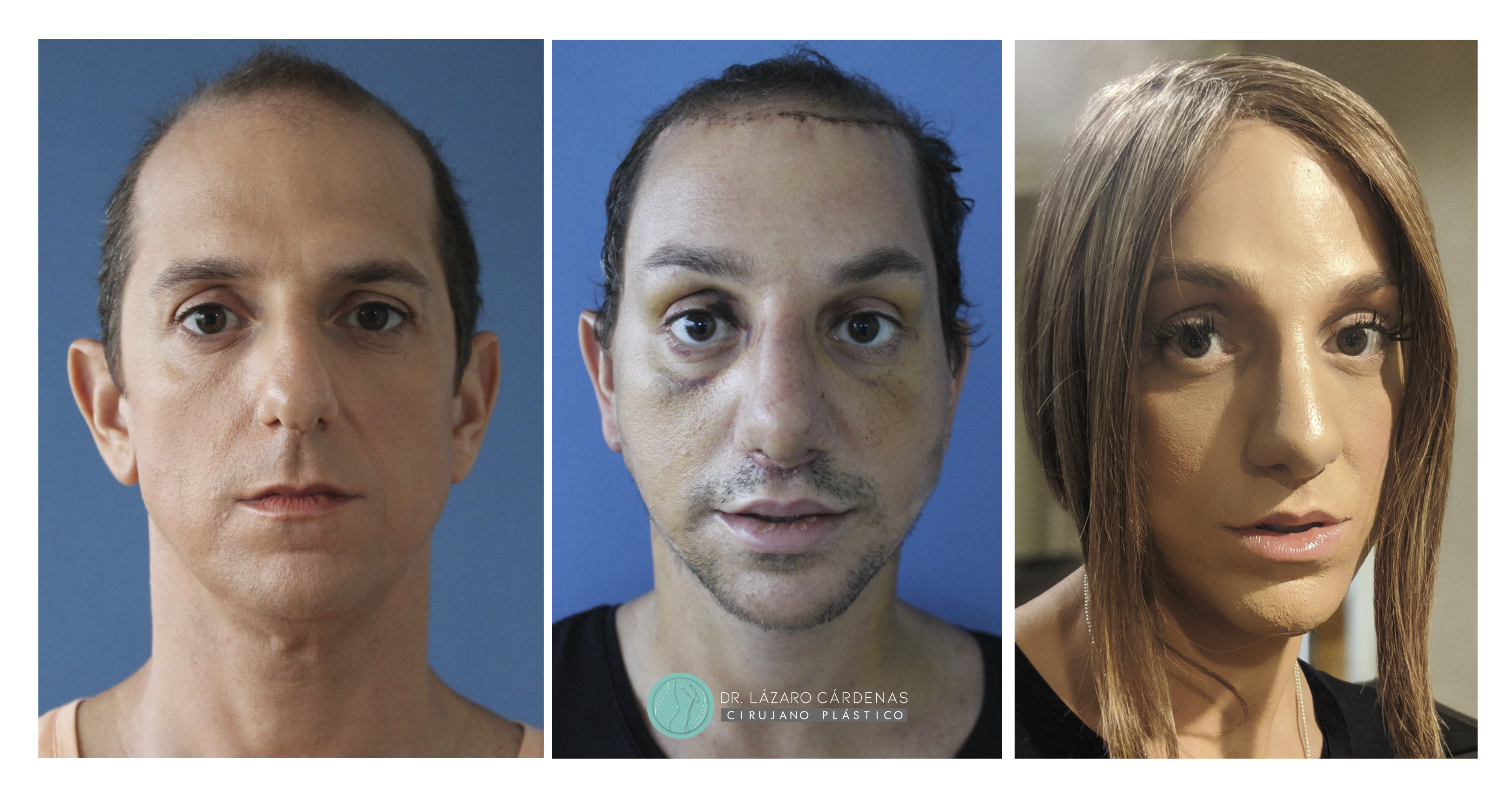 Testimonio Feminización P1 - 01