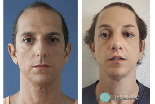 Testimonio Feminización P1 - 02