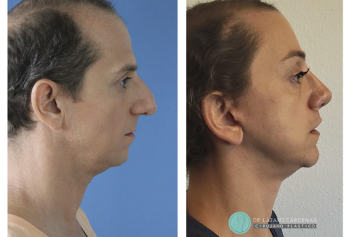 Testimonio Feminización P1 - 04