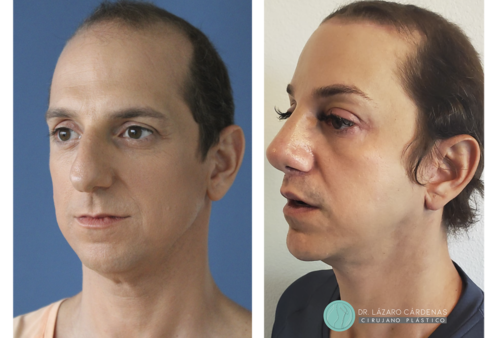 Testimonio Feminización P1 - 05