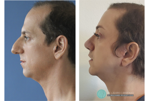 Testimonio Feminización P1 - 06