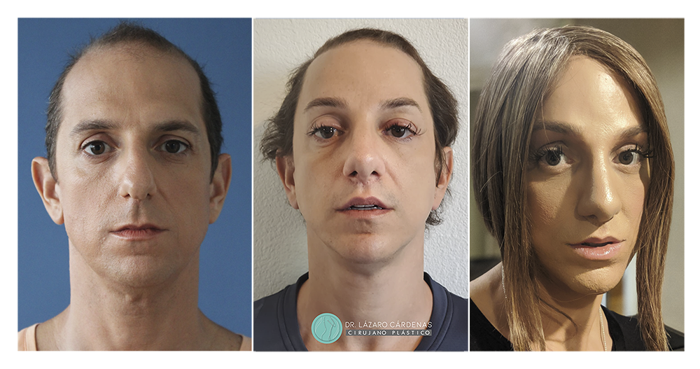 Testimonio Feminización P1 - 01