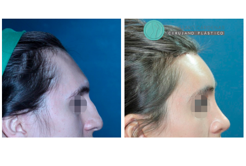 Diseño sin título (23)